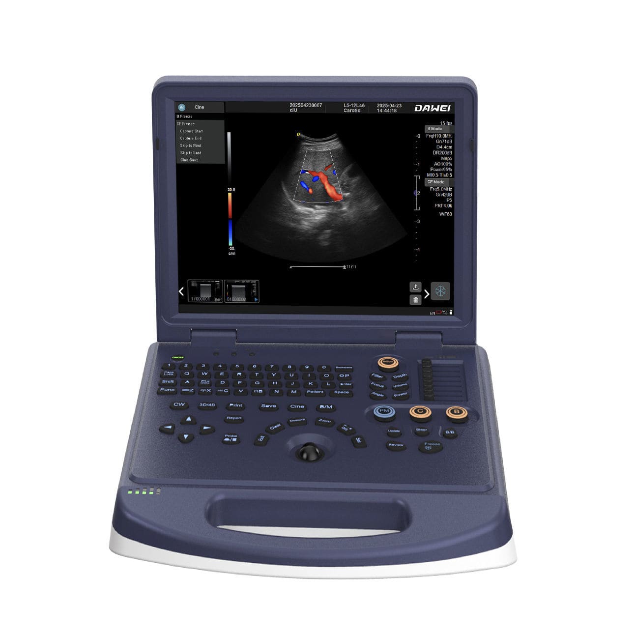 DW L3i Colour-Doppler with Convex Probe
