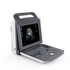 Zoncare M5 Colour Doppler with Convex and Linear or T/V Probes