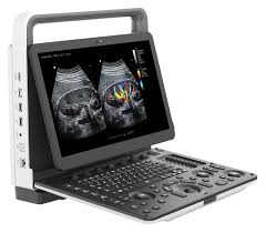Zoncare M30 with 4D Probe + 4D Software