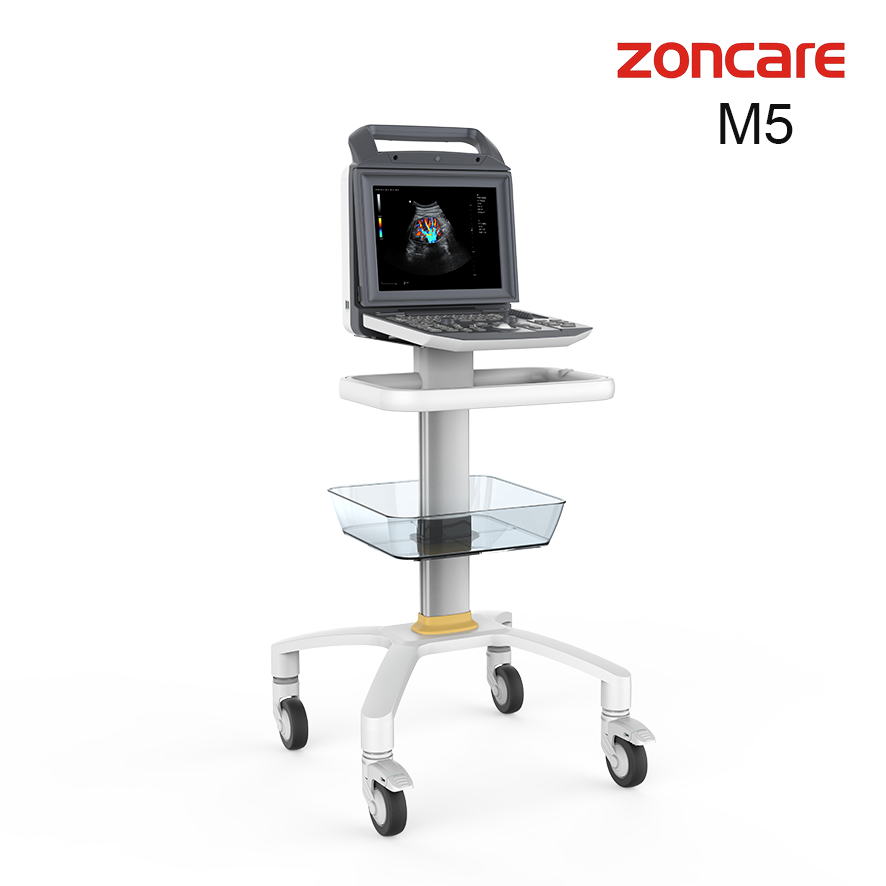 Zoncare M5 Portable Ultrasound